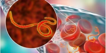 Nationwide Ebola Alert, India mandates screening in airports