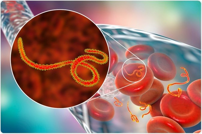 Nationwide Ebola Alert, India mandates screening in airports
